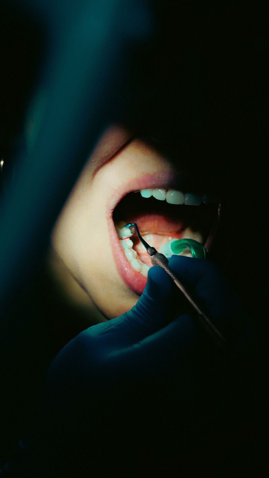 Patient undergoing a routine dental examination