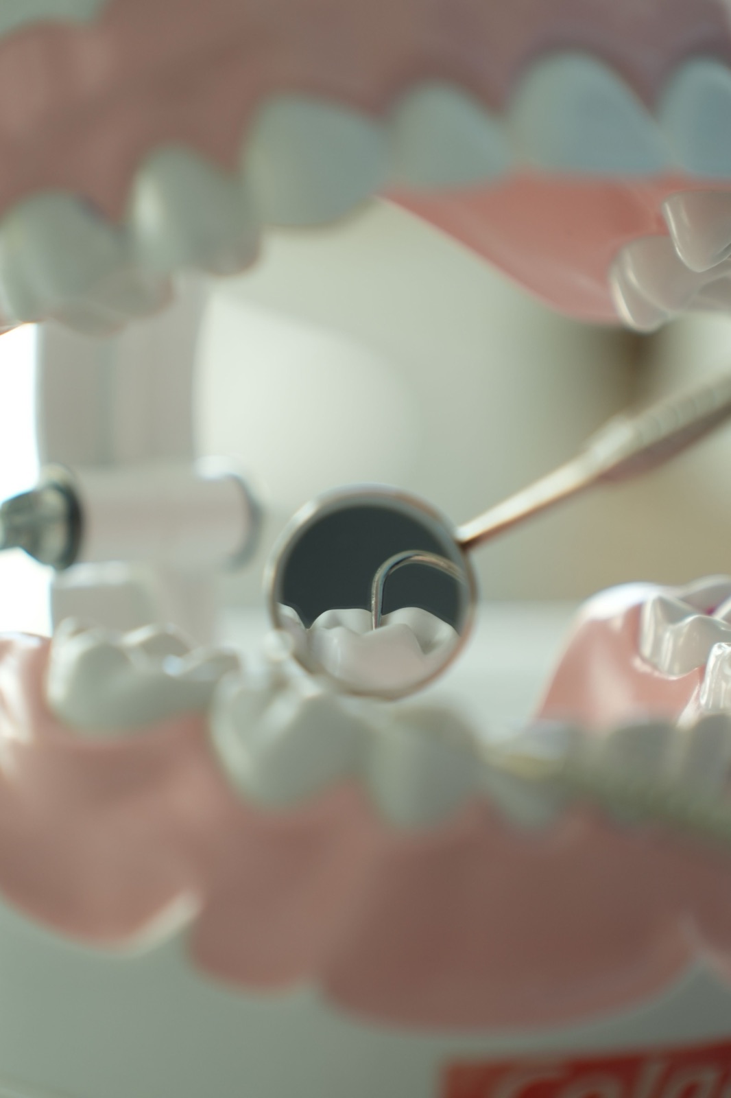 Dental tools and a model of teeth used for treatment planning